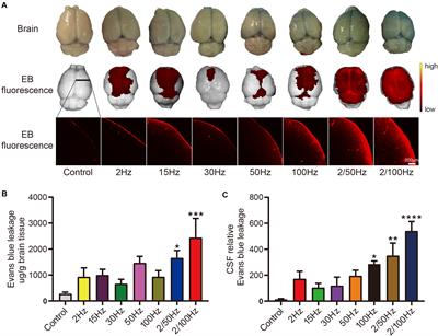 Specific Frequency Electroacupuncture Stimulation Transiently Enhances the Permeability of the Blood-Brain Barrier and Induces Tight Junction Changes